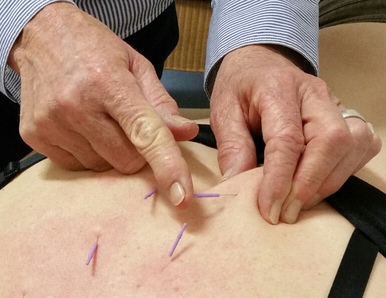 Physiotherapy for women services