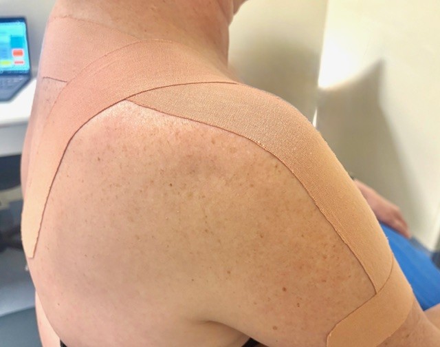Physiotherapy Adelaide - Physiotherapy For Women
