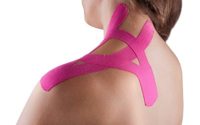Blog 8 Taping for treatment